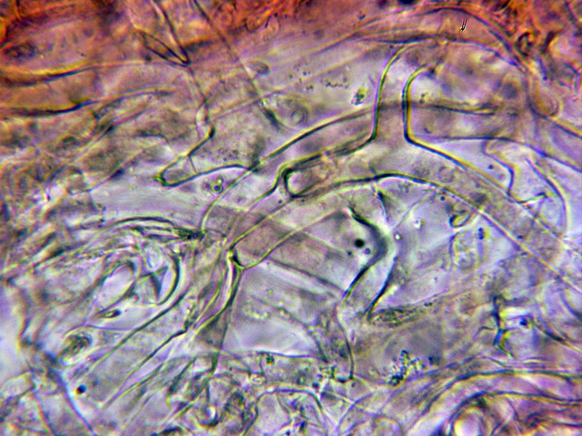Microscopía de Collybiopsis ramealis - 10 - Hifas gruesas subpellis